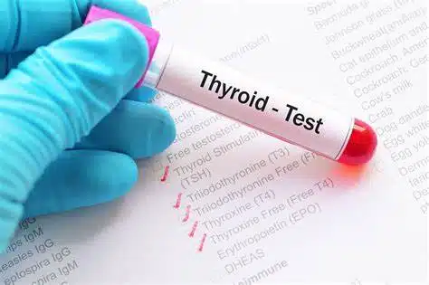 Thyroid Function Tests