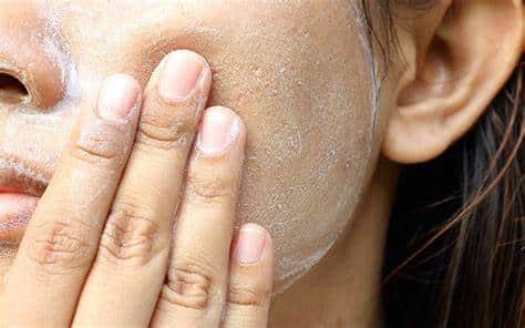 Skin Health