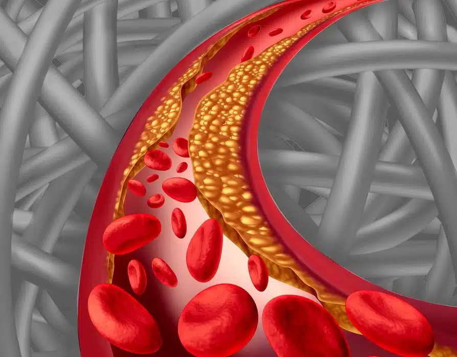 arterial conditions